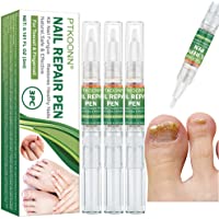 Los mejores  - Tratamiento de Uñas- Hongos Uñas Pies- Pluma de Reparación de Uñas- reparación de uñas- Uñas de los pies y las Uñas…